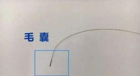 广州亲子鉴定用毛发鉴定准吗